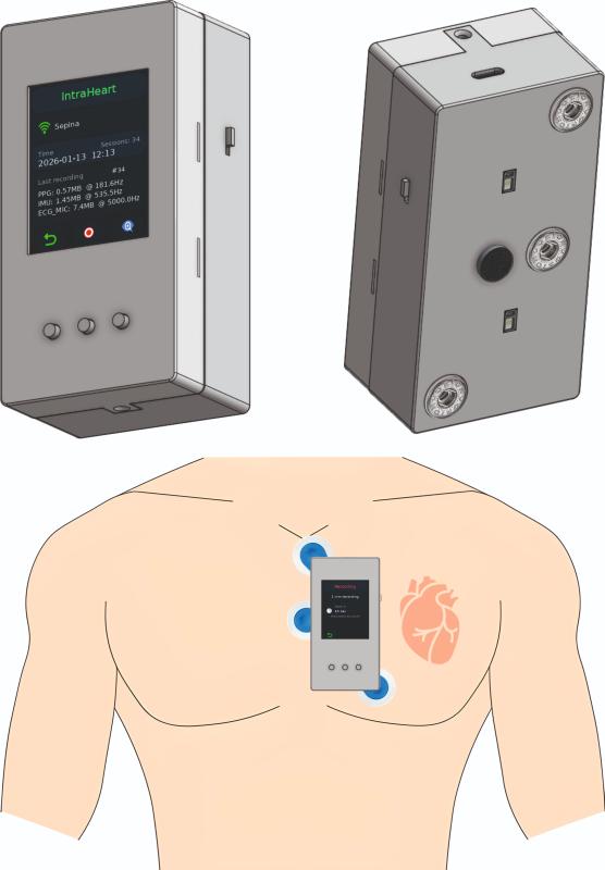 Intra-Heart Pressure Embedded Integration